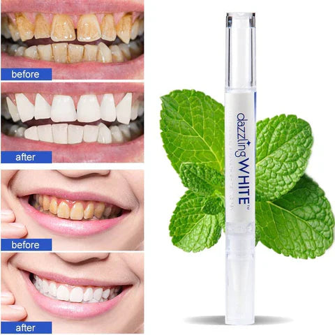 Dazzling White™ Instant Teeth Whitening Pen